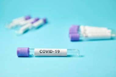 Corona virüsünün hasta örneği. Kan testi tüpleri. Coronavirus covid 19.