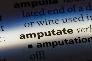 bir sözlüğü'ndeki sözcüğü kesmek. kavramı kesmek.