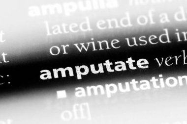 bir sözlüğü'ndeki sözcüğü kesmek. kavramı kesmek.