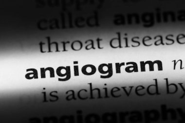 Anjiyo Word'de bir sözlük. Anjiyo kavramı.