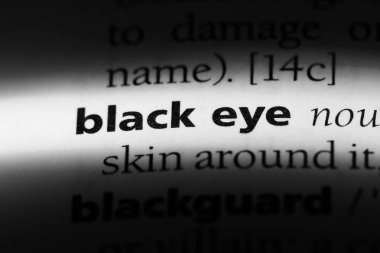 siyah göz Word'de bir sözlük. siyah göz kavramı.