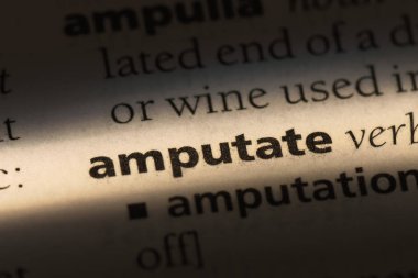 bir sözlüğü'ndeki sözcüğü kesmek. kavramı kesmek.