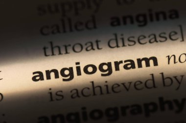 Anjiyo Word'de bir sözlük. Anjiyo kavramı.