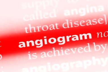 Anjiyo Word'de bir sözlük. Anjiyo kavramı.