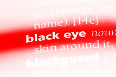 siyah göz Word'de bir sözlük. siyah göz kavramı.