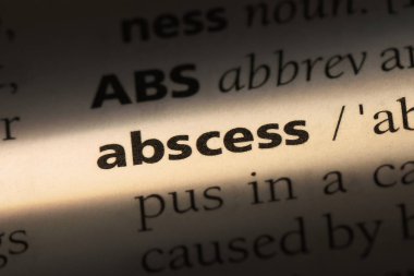 apse Word'de bir sözlük. apse kavramı.