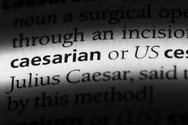 bir sözlüğü'ndeki taraftarlarının sözcüğü. Cesarian kavramı.