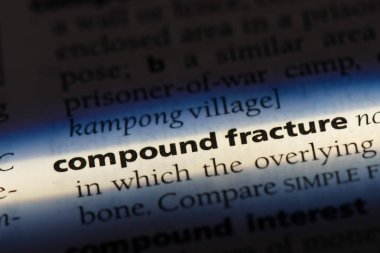 bileşik kırık sözcük sözlüğe. bileşik kırık kavramı