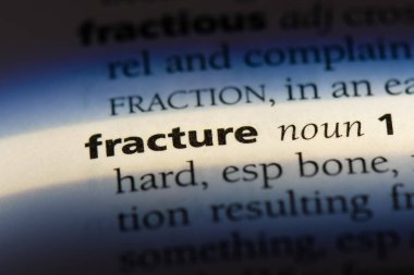 kırık bir sözlük tek kelimeyle. kırık kavramı