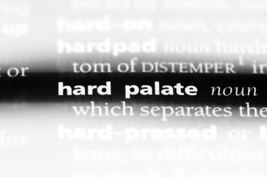 hardpalate sözcük sözlüğe. hardpalate kavramı.