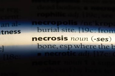 nekroz Word'de bir sözlük. nekroz kavramı.