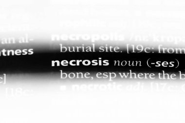 nekroz Word'de bir sözlük. nekroz kavramı.