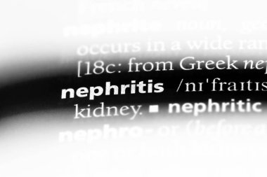 nefrit Word'de bir sözlük. nefrit kavramı.