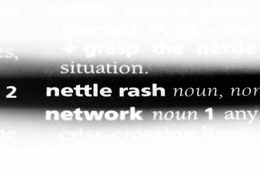 Isırgan döküntü Word'de bir sözlük. Isırgan döküntü kavramı.