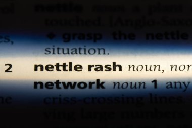 Isırgan döküntü Word'de bir sözlük. Isırgan döküntü kavramı.