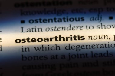 osteoartrit Word'de bir sözlük. osteoartrit kavramı.