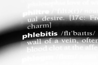 flebit Word'de bir sözlük. flebit kavramı.