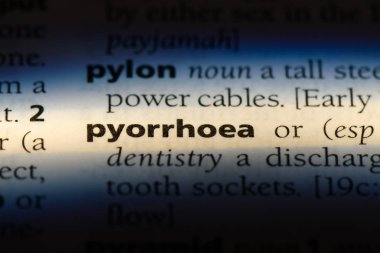 irin Word'de bir sözlük. irin kavramı.