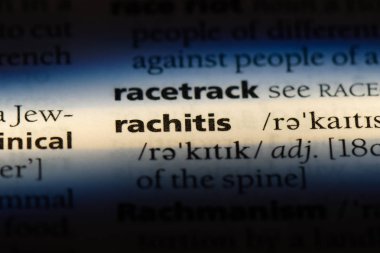 Sözlükte rachitis kelimesi. rachitis konsepti.