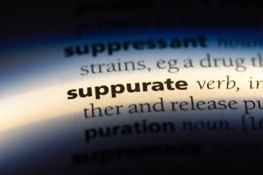 bir sözlüğü'ndeki sözcüğü yapabiliriz. kavram yapabiliriz.