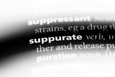 bir sözlüğü'ndeki sözcüğü yapabiliriz. kavram yapabiliriz.