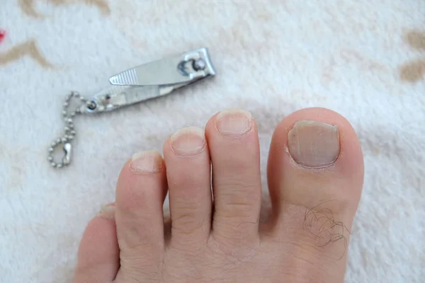 Soins Des Pieds Des Ongles Coupe Longs Ongles Nettoyage Personnel — Photo