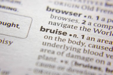 Sözlükte Kelpiş kelimesi veya tümceciği.