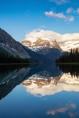 Kanada Rocky Dağları ile çevrili Güzel Marvel Gölü manzarası