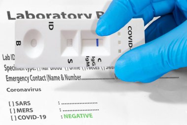 Bir doktorun eli ya da bir laboratuvar teknisyeni, İgM ve IgG antikorlarının Roman Coronavirus 'a, SARS-CoV-2' ye gönderildiğini tespit etmek için hızlı bir COVID-19 testi gösteriyor..