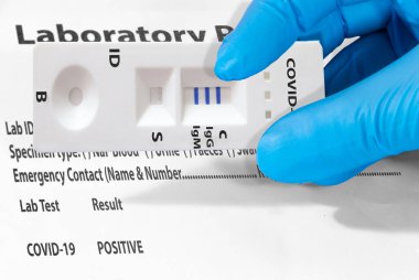 Bir doktorun eli ya da bir laboratuvar teknisyeni, IgM ve IgG antikorlarını Roman Coronavirus, SARS-CoV-2 'ye tespit etmek için hızlı COVID-19 testi gösteriyor..