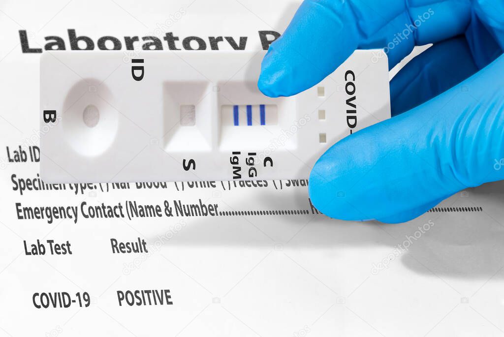 Hand of a Doctor or a laboratory technician shows rapid laboratory COVID-19 test to detect IgM and IgG antibodies to Novel Coronavirus, SARS-CoV-2 with positive result.