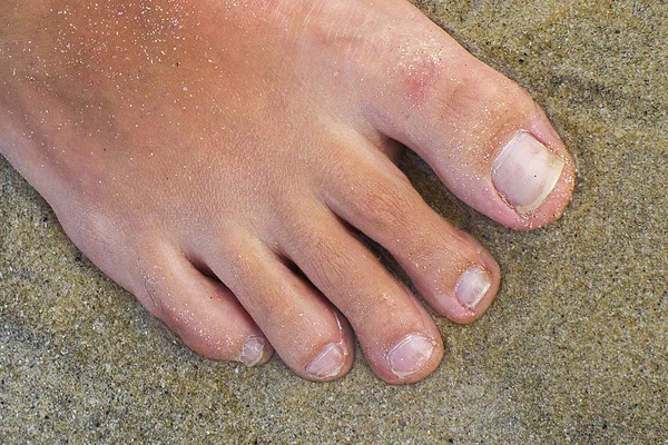 Γυναικειο Πόδι Σταθερά Ένα Κοντινό Πλάνο Πάνω Στην Άμμο Πεντικιούρ — Φωτογραφία Αρχείου