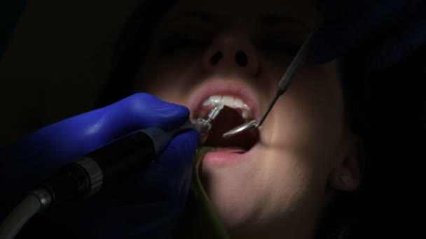 Mãos Dentista Seguram Ferramenta Para Limpar Dentes Uma Jovem — Vídeo de Stock