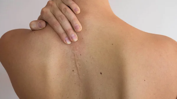 Nek Rugpijn Close Van Hand Van Een Vrouw Houdt Haar — Stockfoto