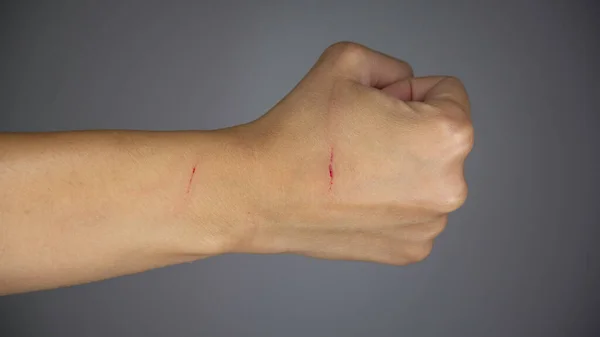 Scratched hand in the shape of a fist on a gray background