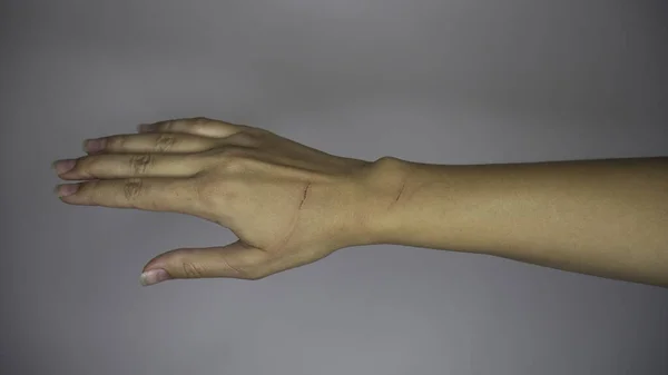 Die Hand Einer Frau Nach Einem Kratzer — Stockfoto