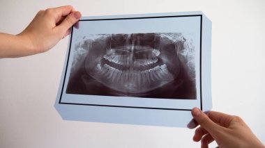 X-ray diş taraması yapan kadınların elleri.. 