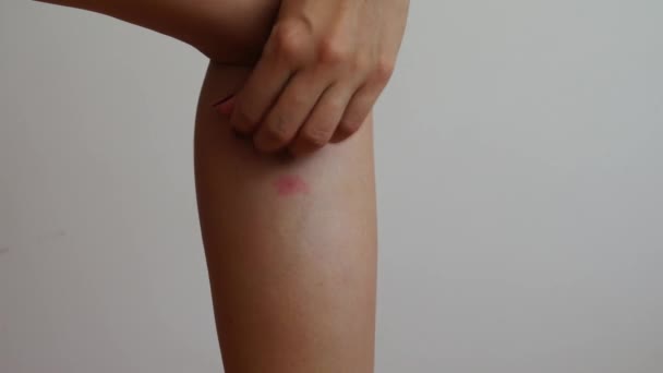 Женская Рука Царапает Укус Насекомого Ноге — стоковое видео