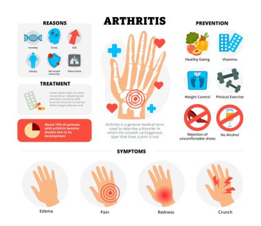Eklem iltihabı, el kemiği iskeleti olan bilgi tasarımı. Sebepleri, semptomları, tedaviyi ve tıp eğitimini önlemeyi gösteren taşıyıcı poster şablonu, sağlık hizmeti farkındalığı, grafik illüstrasyon afişi.