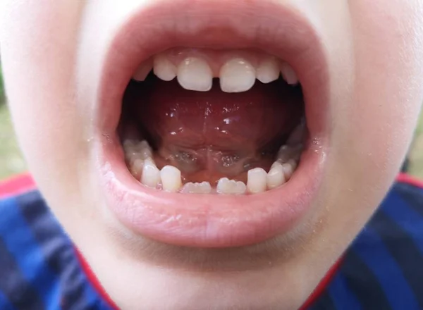 Szczegóły Dotyczące Jamy Ustnej Zębami Mleka — Zdjęcie stockowe