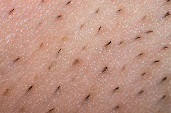 İnsan derisi yakın çekim saç büyüyen