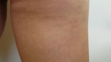 ayak kız aşırı kilo krem