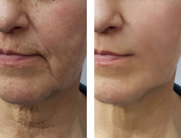Face Elderly Woman Wrinkles — Stock Photo, Image