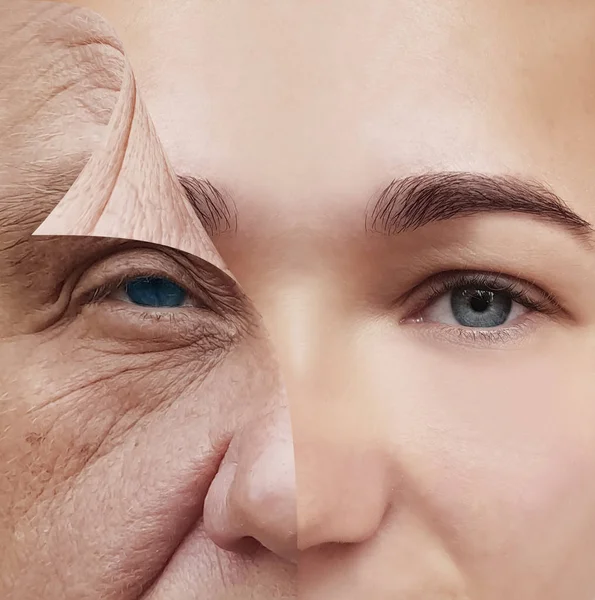 Wajah Muda Dan Tua Sebelum Dan Sesudah Konsep — Stok Foto