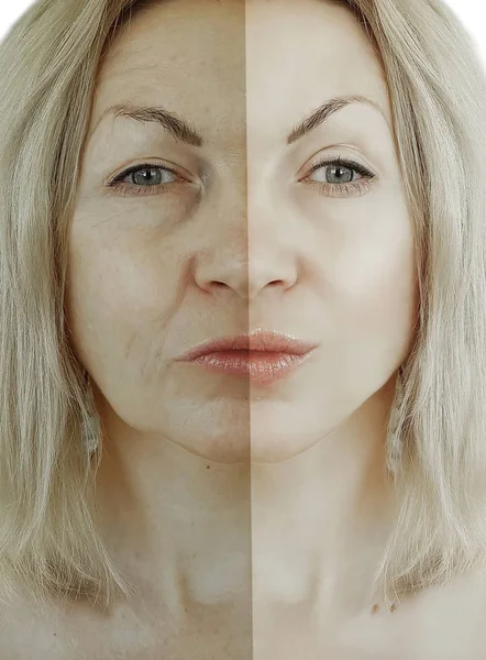Arrugas Mujer Cara Antes Después Del Envejecimiento Concepto — Foto de Stock