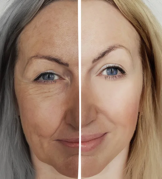 Frau Falten Gesicht Vor Und Nach Dem Altern Konzept — Stockfoto