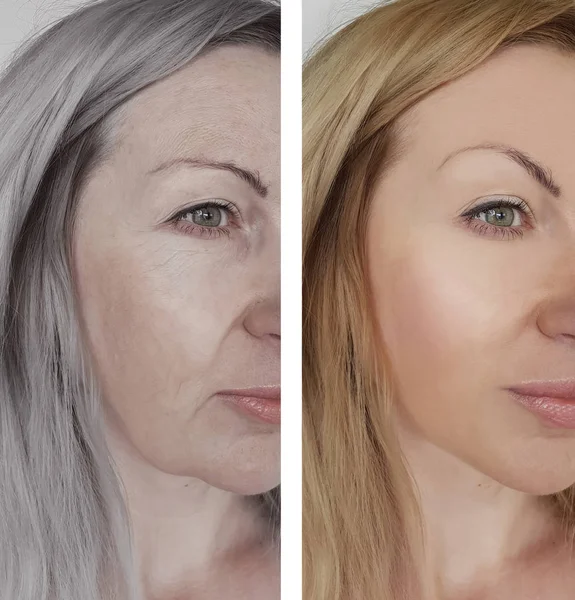 woman wrinkles face before and after aging concept