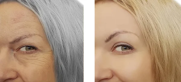 女性老化之前和之后概念灰色 — 图库照片