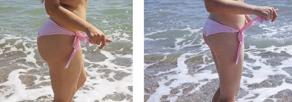Mädchen Badeanzug Das Vor Und Nach Der Diät Abnimmt — Stockfoto