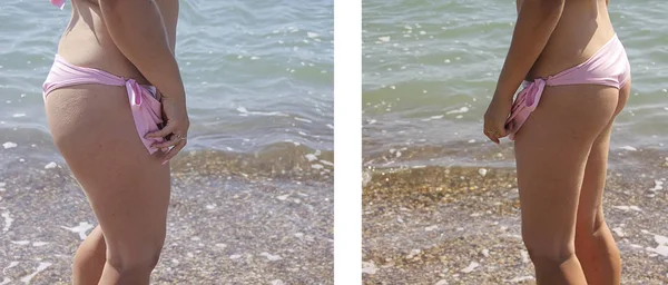 Dziewczyna Morzu Kostium Kąpielowy Wyszczuplające Przed Diecie — Zdjęcie stockowe